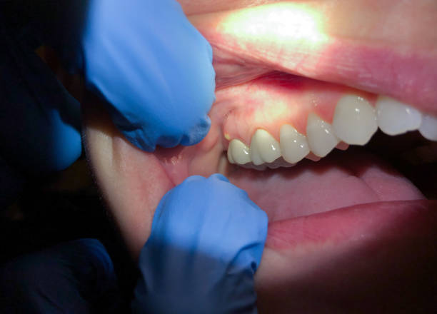  Choudrant, LA Emergency Dentist Pros
