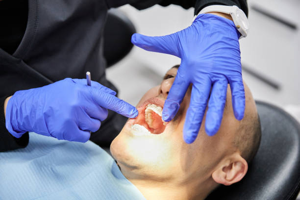Best Emergency Wisdom Teeth Removal in Choudrant, LA